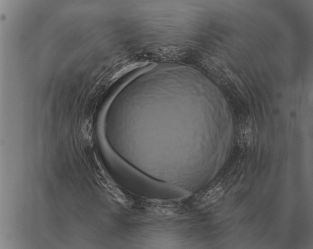 X0000087341010200705181056