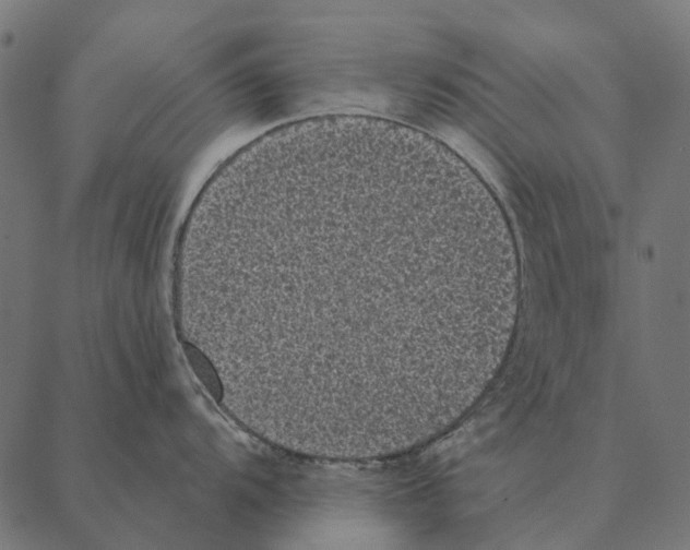 X0000087341104200705181055