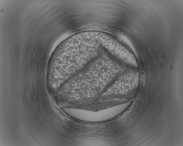 X0000087341146200705181055
