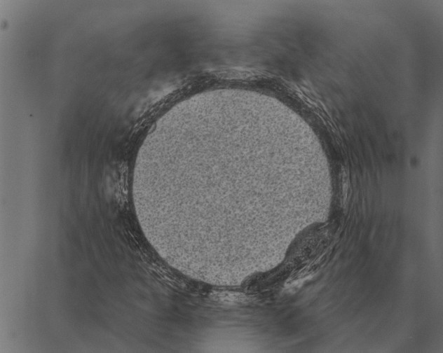 X0000087341301200705181051