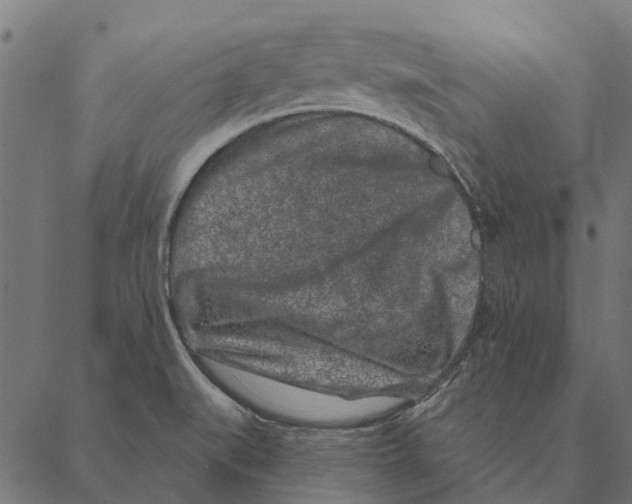 X0000087341519200705181048