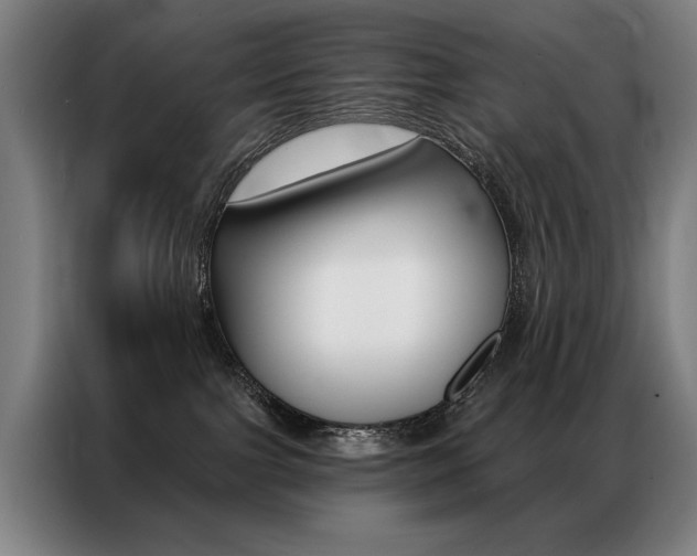 X0000087350091200704200814