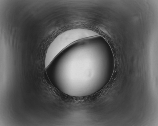 X0000087350965200704200801