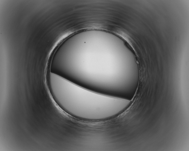 X0000087351139200704200759