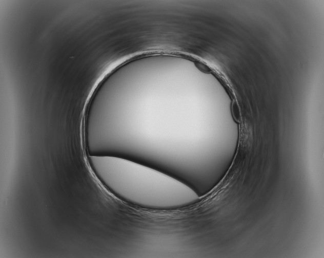X0000087351295200704200756