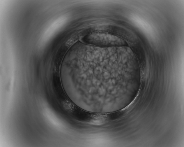 X0000087350191200704271426