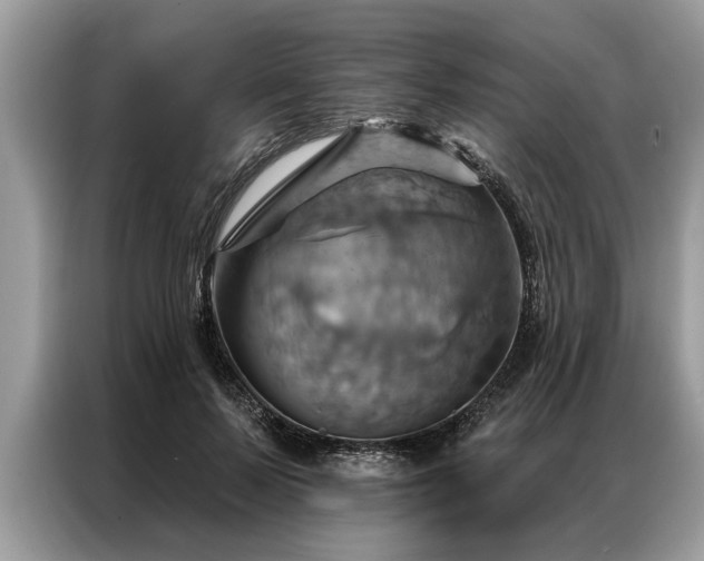 X0000087350695200704271419