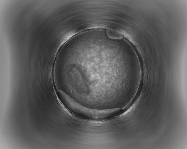 X0000087351137200704271415