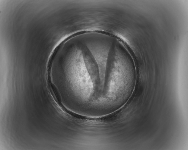 X0000087351460200704271411
