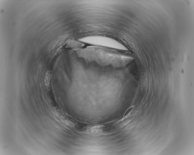 X0000087350078200705111630