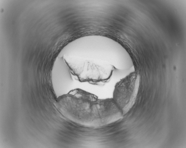 X0000087350185200705111629