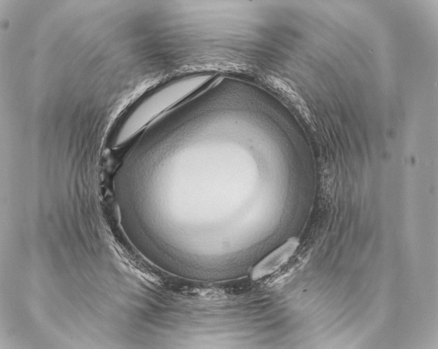 X0000087350395200705111625