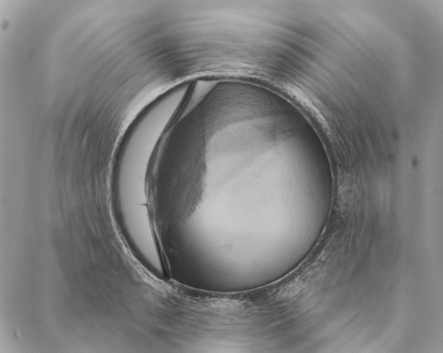 X0000087351085200705111614