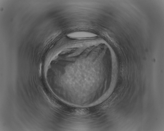 X0000087350070200705181137