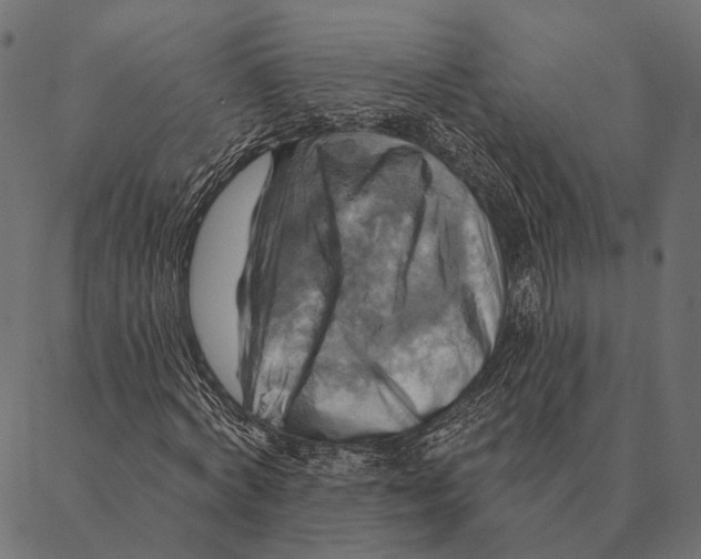 X0000087350772200705181125