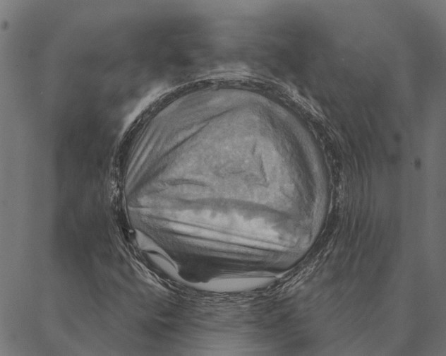 X0000087351400200705181114