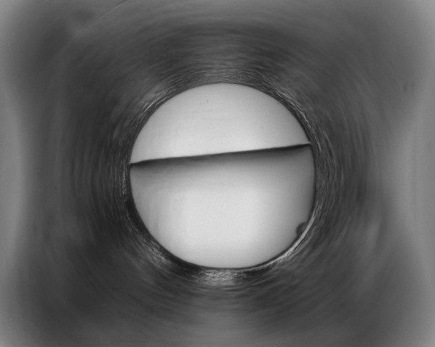 X0000087360144200704200833