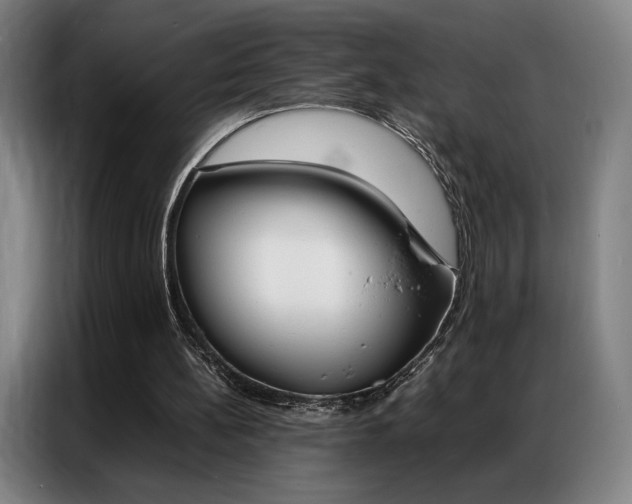 X0000087360148200704200833