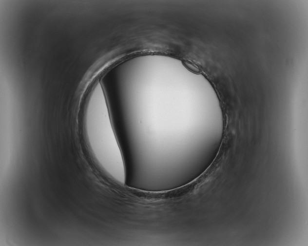 X0000087360247200704200832