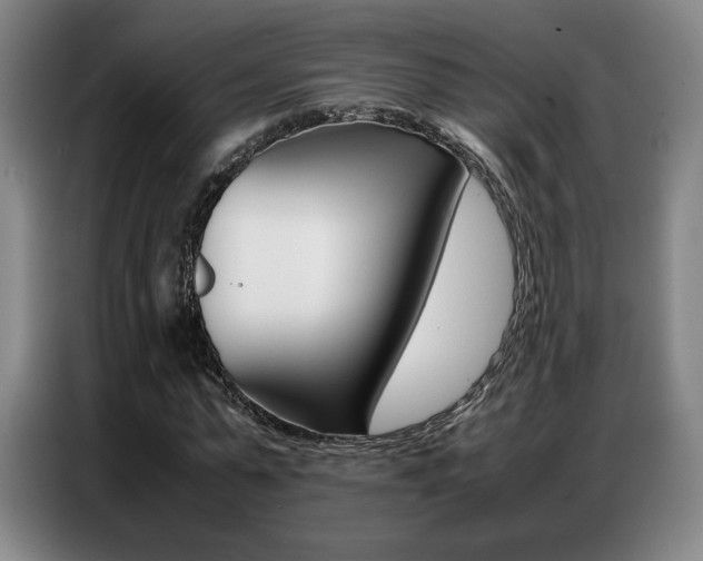 X0000087360775200704200825