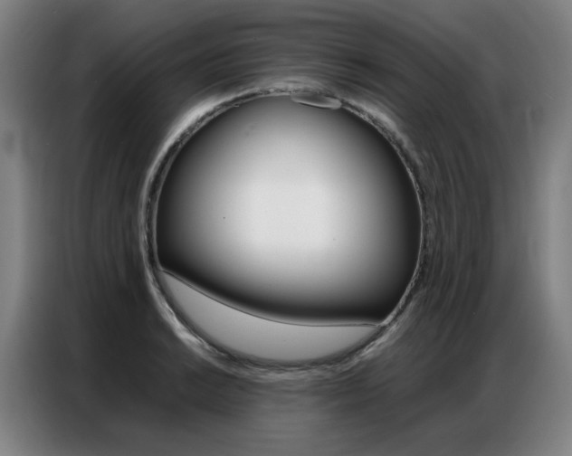 X0000087361038200704200821