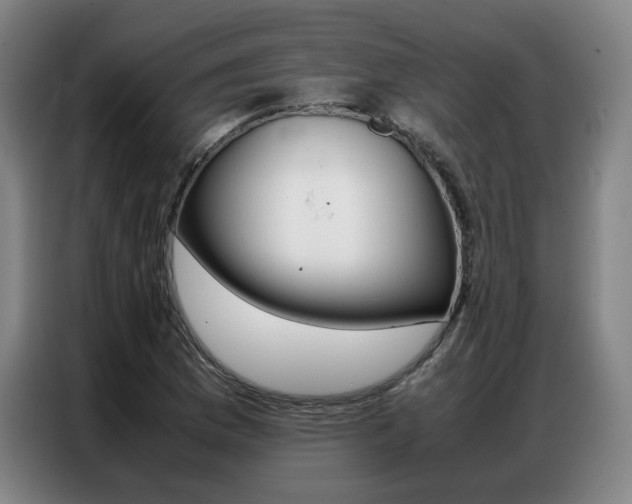 X0000087361169200704200819