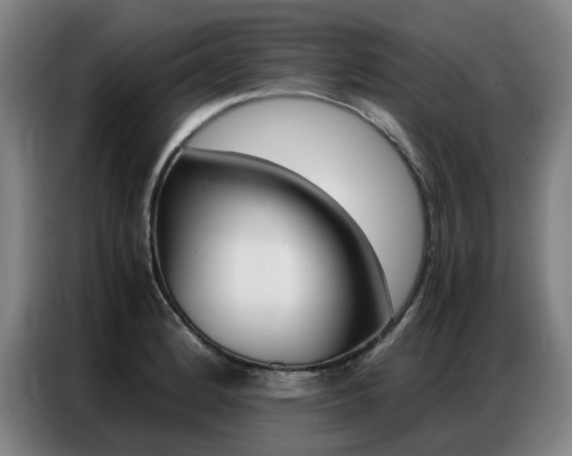 X0000087361184200704200819