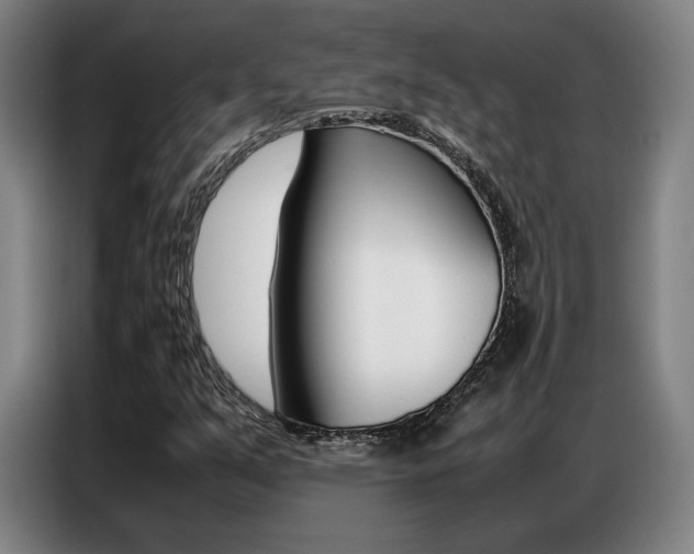 X0000087361351200704200817