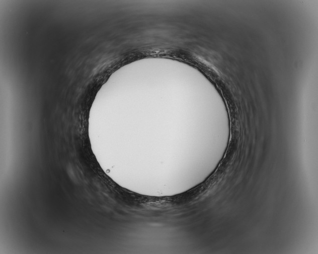 X0000087361447200704200816