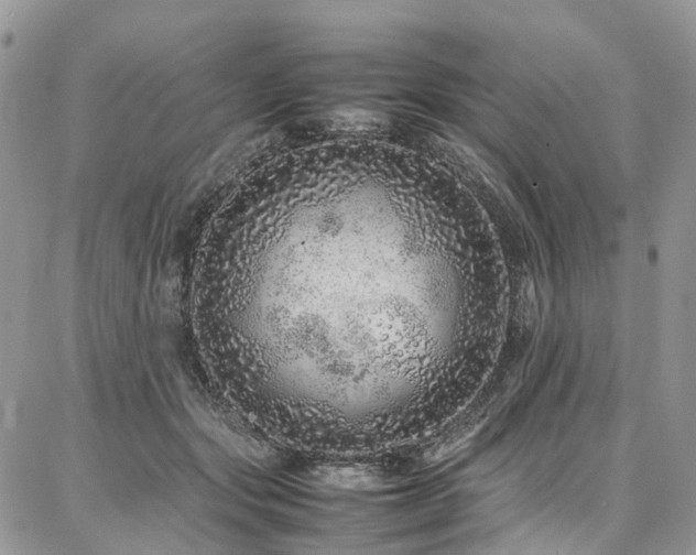 X0000087360557200704201150