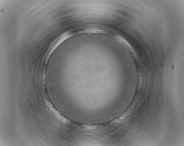 X0000087360852200704201145
