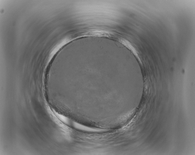 X0000087361091200704201141