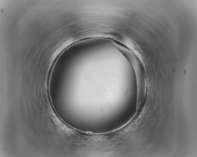 X0000087361189200704201139