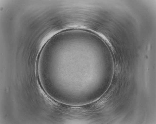X0000087361295200704201138