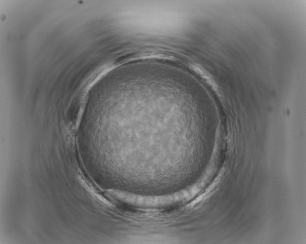 X0000087361369200704201136