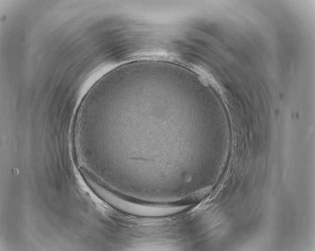 X0000087361440200704201136