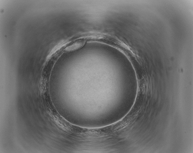 X0000087361448200704201135