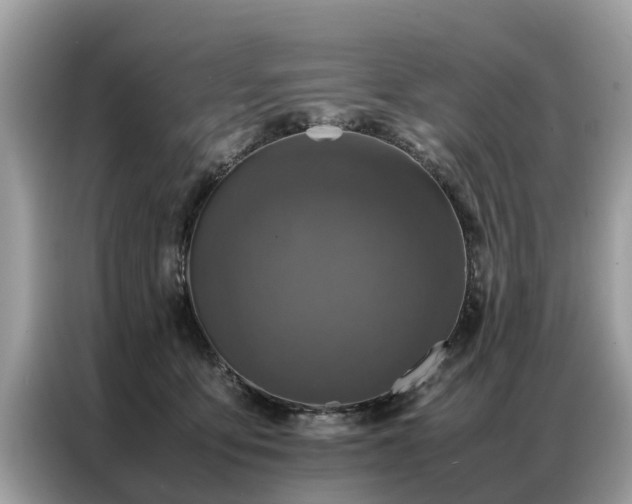 X0000087360419200704271440