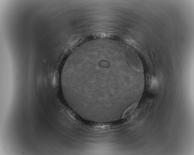 X0000087360760200704271437