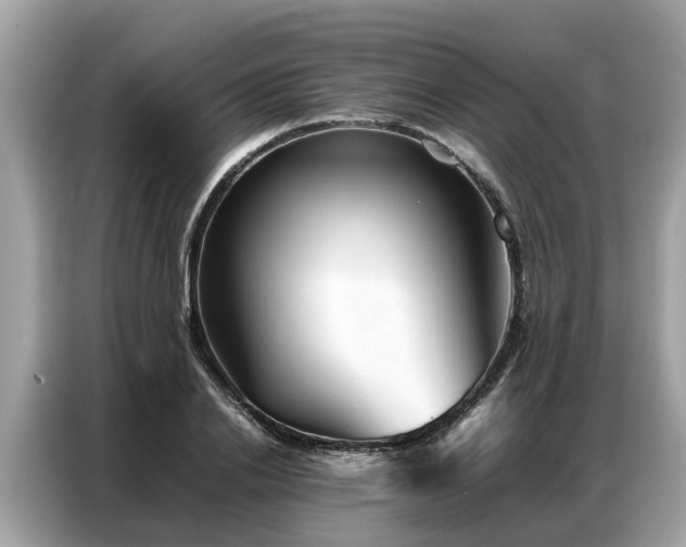 X0000087360838200704271436