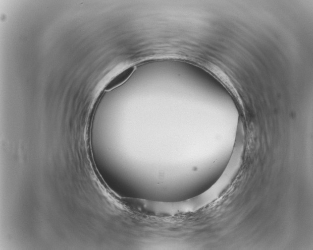 X0000087361197200705041847