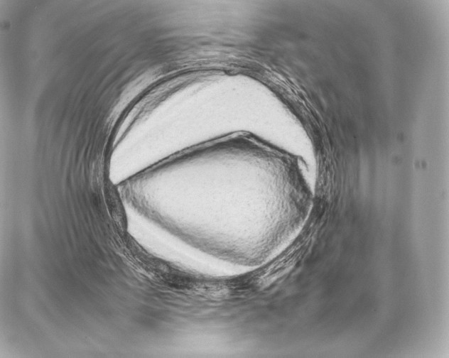 X0000087360099200705111655