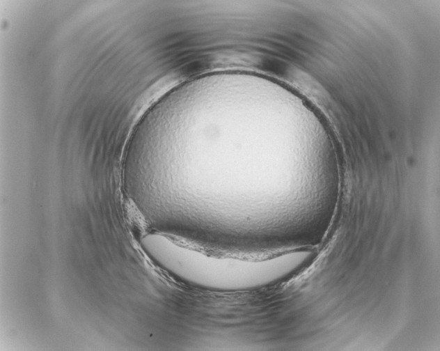 X0000087361145200705111638