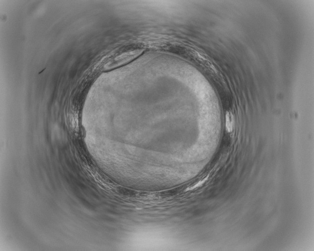 X0000087361155200705111638