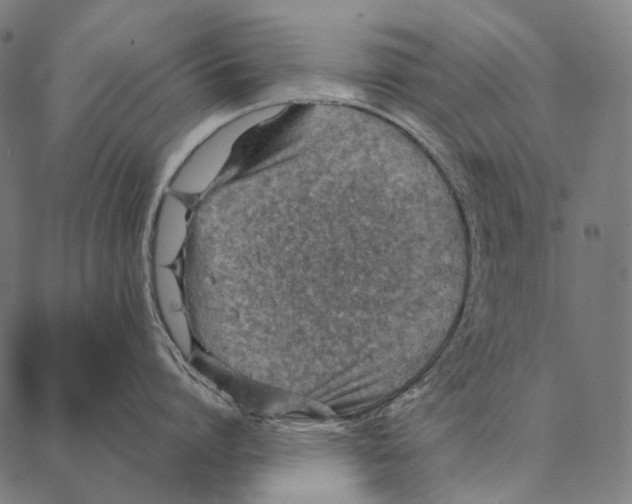 X0000087360864200705181150