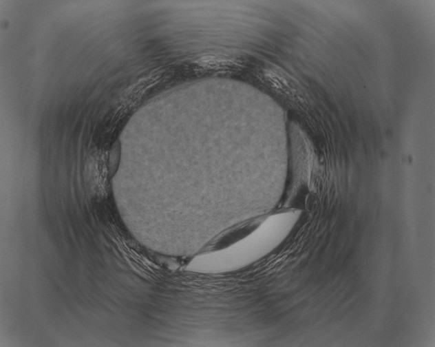 X0000087360868200705181149