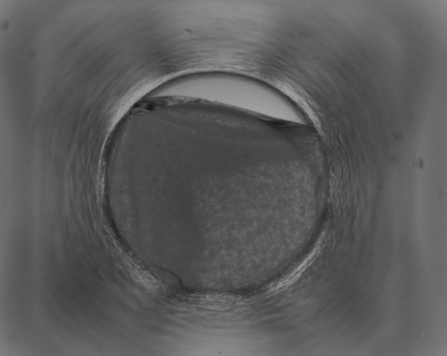 X0000087361077200705181145