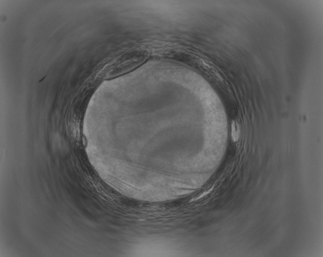 X0000087361155200705181144