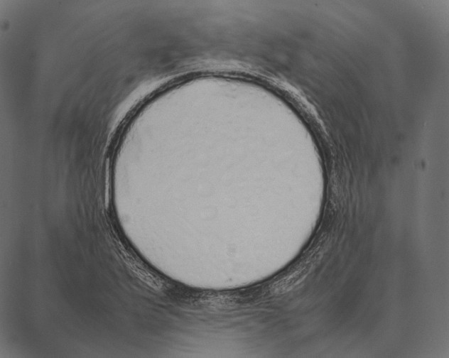 X0000087361175200705181144