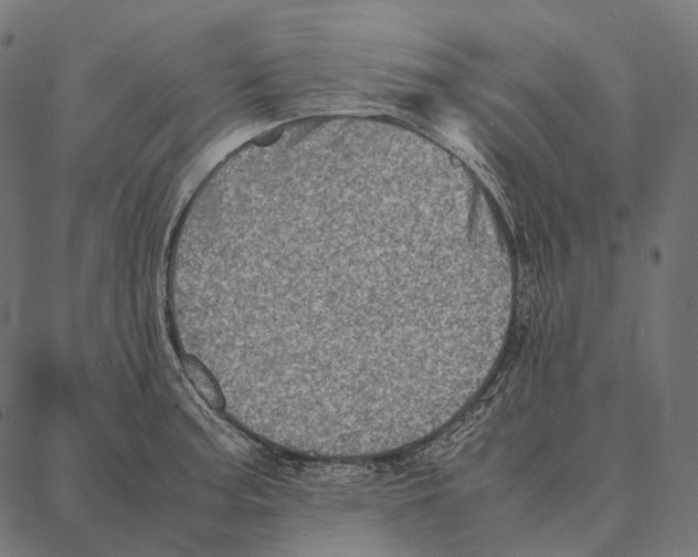 X0000087361187200705181144